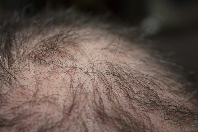 I prodotti anticaduta per capelli: quali sono i più sicuri da utilizzare