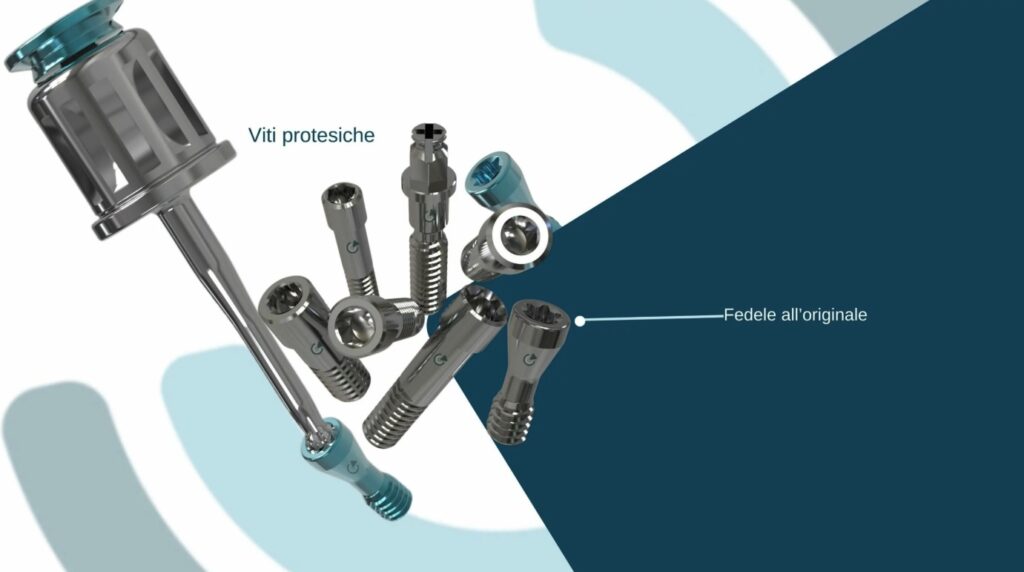 Viti per impianti dentali: sono sicure e durevoli nel tempo?